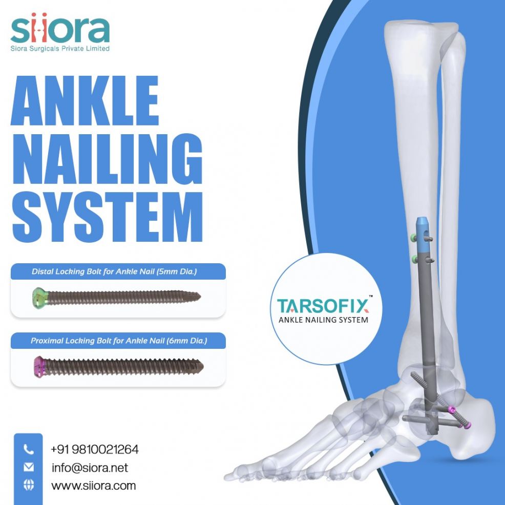 Ankle Nailing System Siora Surgicals